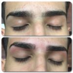 before and after threading 2